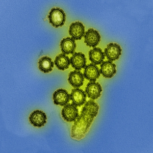 H1N1_Influenza_Virus_Particles_(8411599236)_credit_NIAID_cc-by-20
